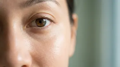 Gros plan sur l'œil d'une femme pour illustrer le traitement des cernes.
