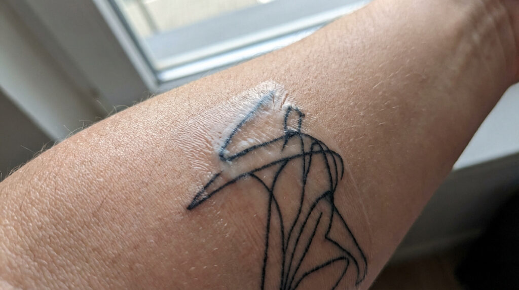 Gros plan sur un bras avec un tatouage linéaire noir. Une pellicule blanche et squameuse, ou 'silver skin', recouvre partiellement l'encre.